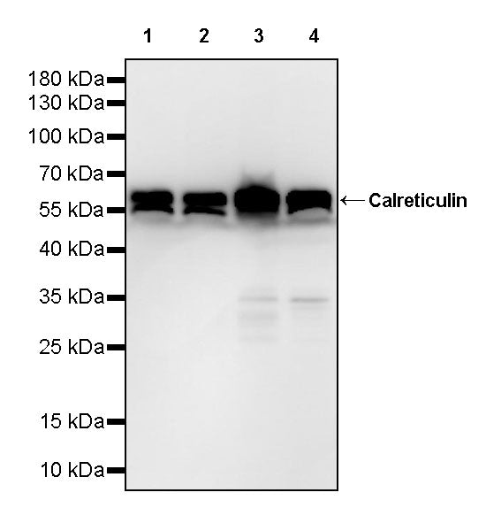Calreticulin Recombinant Rabbit mAb (S-3920-39)