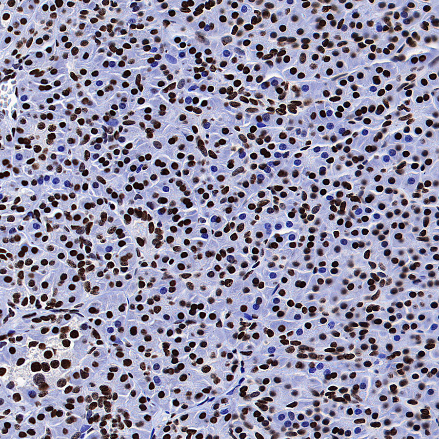 ZMYND8 Recombinant Rabbit mAb (S-5407)