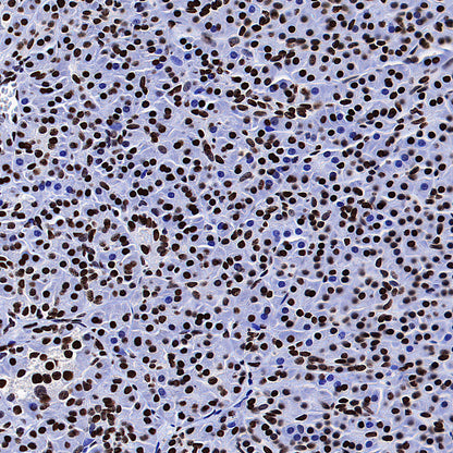 ZMYND8 Recombinant Rabbit mAb (S-5407)