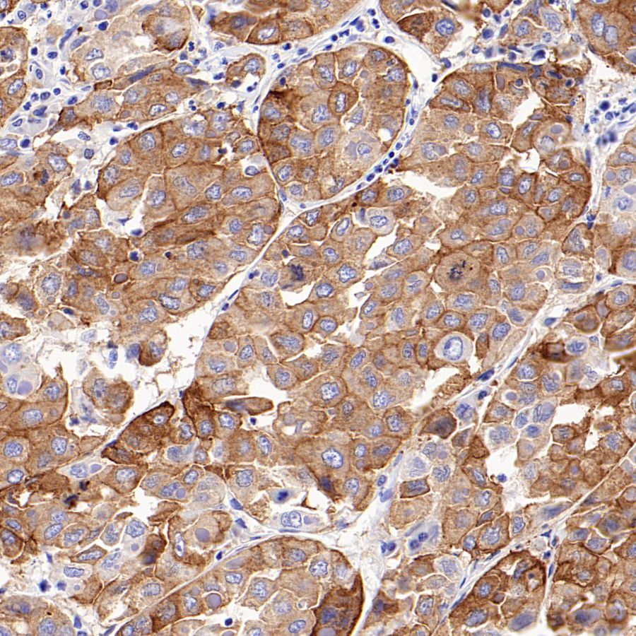 ASGR2 Recombinant Rabbit mAb (SDT-2059-47)