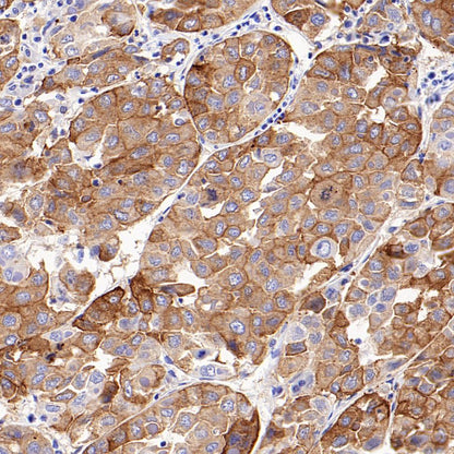 ASGR2 Recombinant Rabbit mAb (SDT-2059-47)