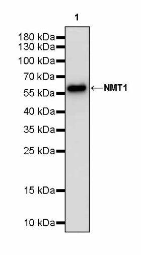 NMT1 Recombinant Rabbit mAb (S-2986-17)