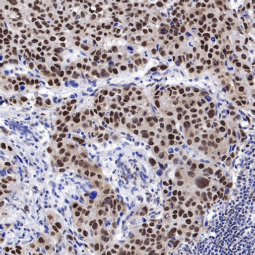 FUS Recombinant Rabbit mAb (S-1015-21)