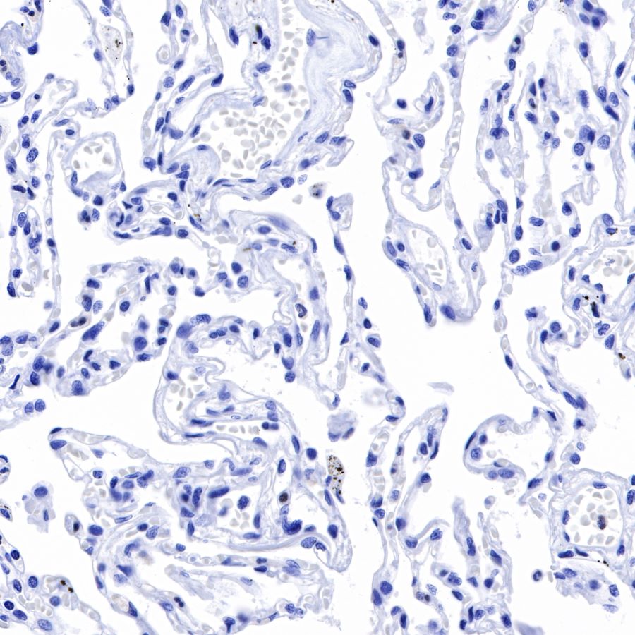 Claudin18.2 Recombinant Rabbit mAb,PBS Only (SDT-102-24)