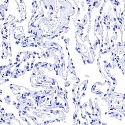 Claudin18.2 Recombinant Rabbit mAb,PBS Only (SDT-102-24)