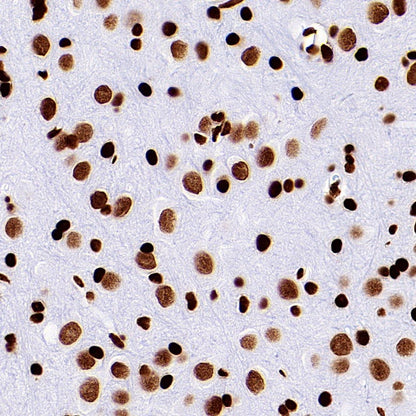 Histone H3 (acetyl K9) Recombinant Rabbit mAb (S-1704-76)