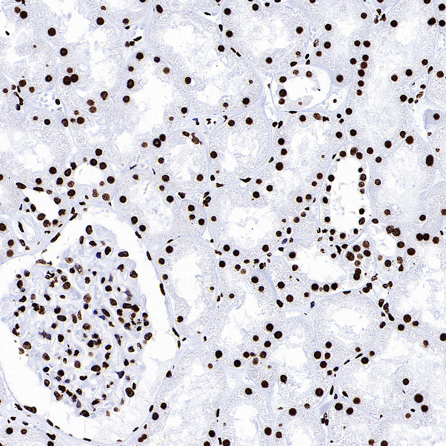 Histone H3 (tri methyl K27) Recombinant Rabbit mAb (S-4331)