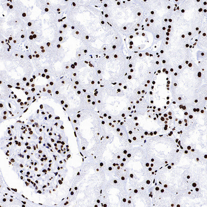 Histone H3 (tri methyl K27) Recombinant Rabbit mAb (S-4331)