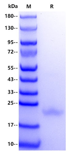 Biotinylated CD40L/CD154/TRAP/gp39 His&Avi tag Protein, Human