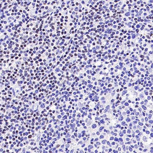 Ctip2 Recombinant Rabbit mAb (S-1375-21)
