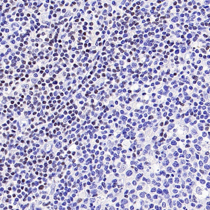 Ctip2 Recombinant Rabbit mAb (S-1375-21)