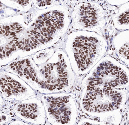 TDP-43 Recombinant Rabbit mAb (S-989-41)
