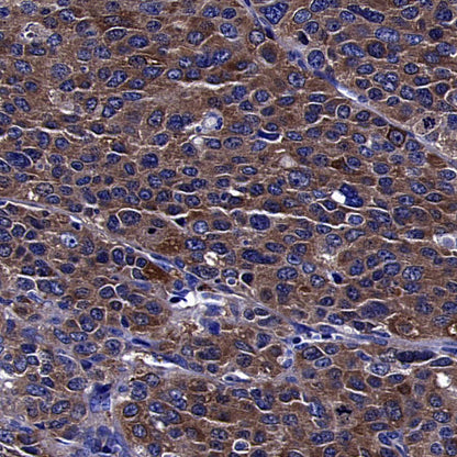 AKT1S1/PRAS40 Recombinant Rabbit mAb (S-4240-49)