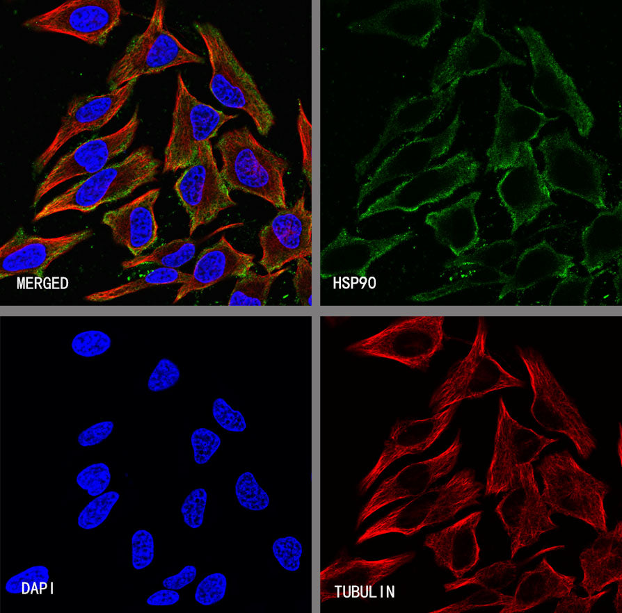 HSP90 Recombinant Rabbit mAb (S-5412)