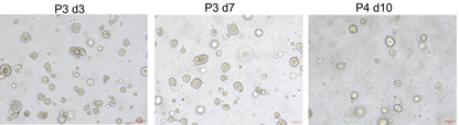 Noggin Protein, Human