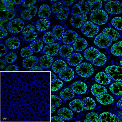 TROP1/EPCAM Recombinant Rabbit mAb (S-1379-5)