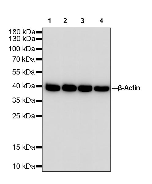 β-Actin Recombinant Rabbit mAb (S-5701)
