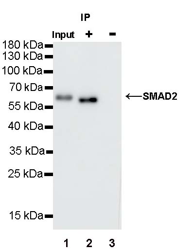 SMAD2 Recombinant Rabbit mAb (S-1420-20)