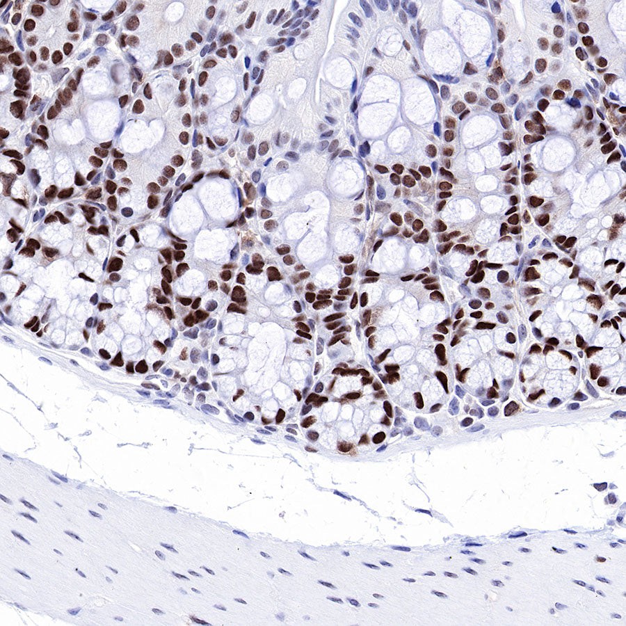 S-RMab® MSH6 Recombinant Rabbit mAb,PBS Only (SDT-R094)