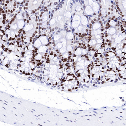 S-RMab® MSH6 Recombinant Rabbit mAb,PBS Only (SDT-R094)