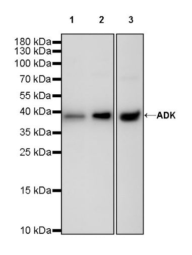 ADK Rabbit Polyclonal Antibody