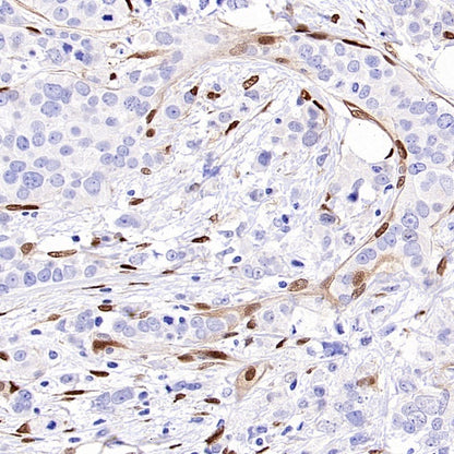 TAZ Recombinant Rabbit mAb (S-2812-102)