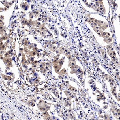 GSK3β Recombinant Rabbit mAb (S-1209-102)