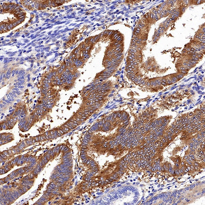 ALDH1L1 Recombinant Rabbit mAb (S-2885-49)