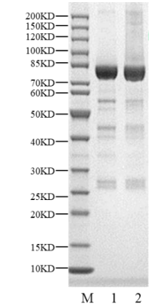 SGK3 GST Tag Protein, Human