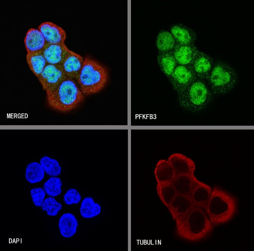 PFKFB3 Recombinant Rabbit mAb (S-653-35)