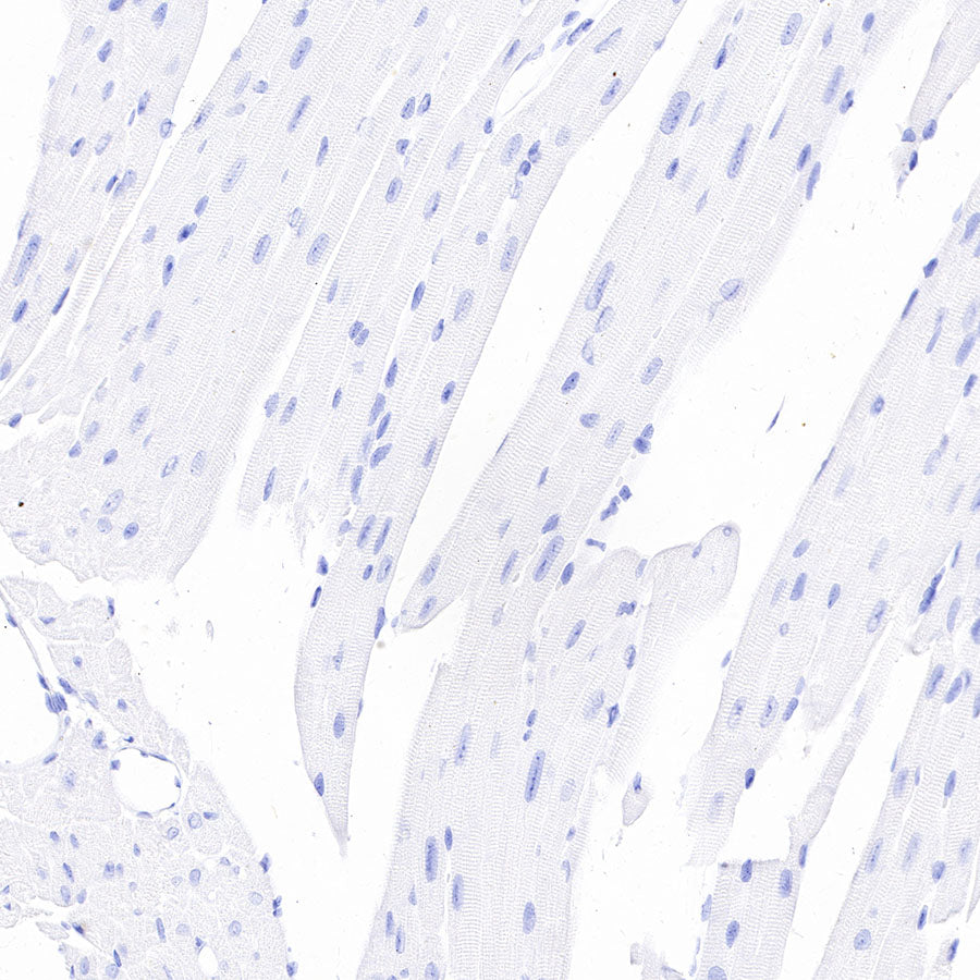Thyroglobulin Recombinant Rabbit mAb (SDT-209-297)