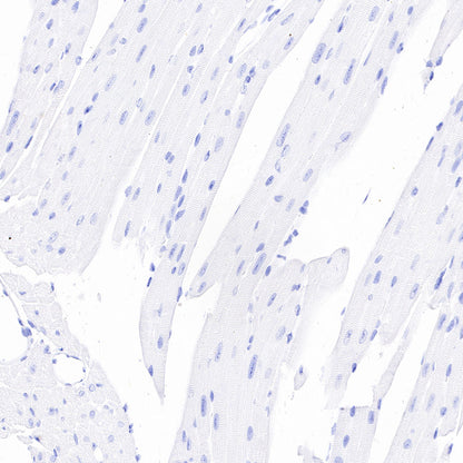Thyroglobulin Recombinant Rabbit mAb (SDT-209-297)