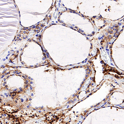 TSH Receptor/TSH-R Recombinant Rabbit mAb (S-5699)