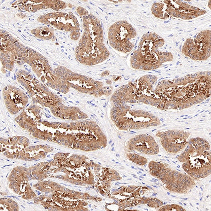 KLK2 Recombinant Rabbit mAb (SDT-4461-19)
