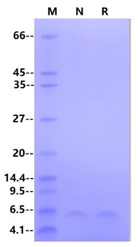 HBV Surface Antigen-preS2 Protein
