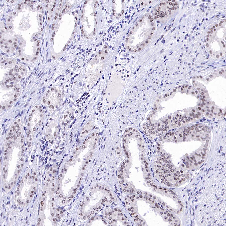 DGCR8 Recombinant Rabbit mAb (S-4082-6)
