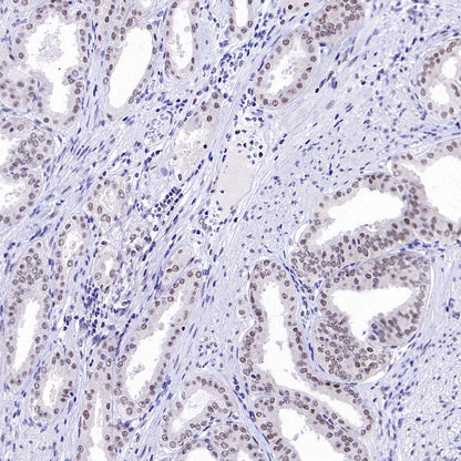 DGCR8 Recombinant Rabbit mAb (S-4082-6)