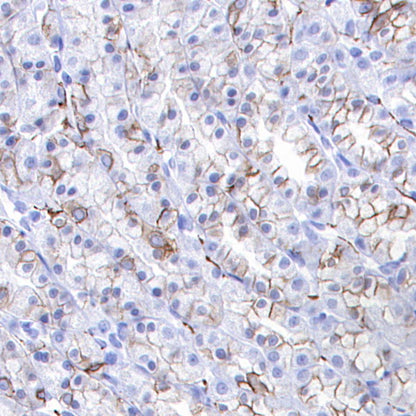 ALCAM Recombinant Rabbit mAb (S-4080-21)