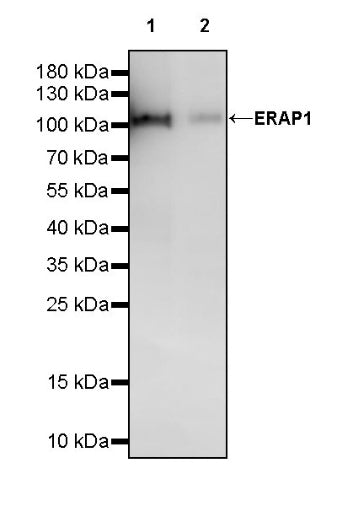 ERAP1 Recombinant Rabbit mAb (S-2509-38)