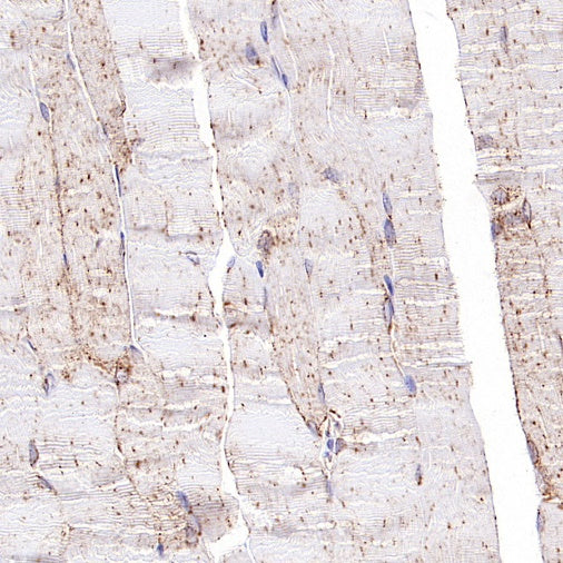 GLUT4 Recombinant Rabbit mAb (S-584-50)