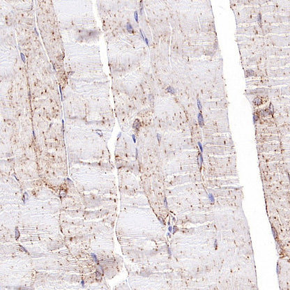 GLUT4 Recombinant Rabbit mAb (S-584-50)