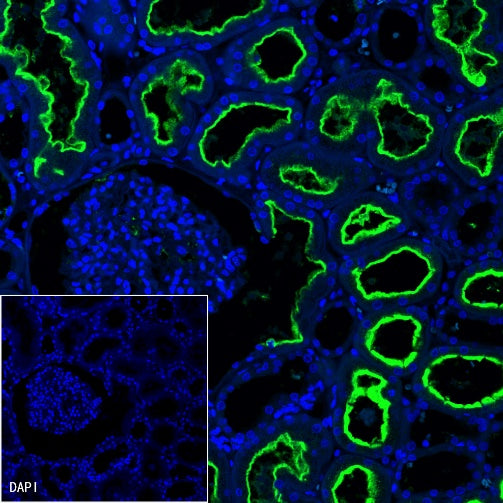 ACE2 Recombinant Rabbit mAb (S-1348-7)