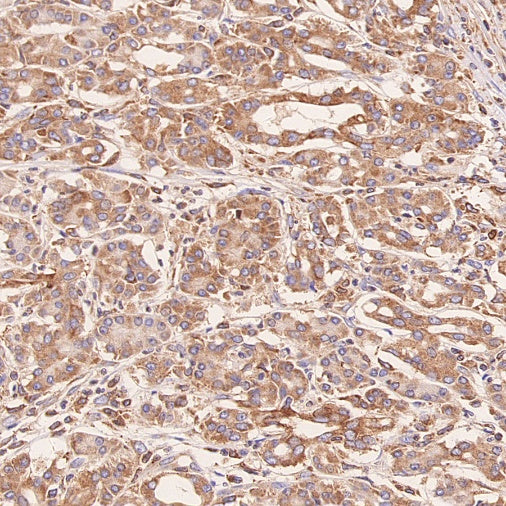 ERAP1 Recombinant Rabbit mAb (S-2509-38)