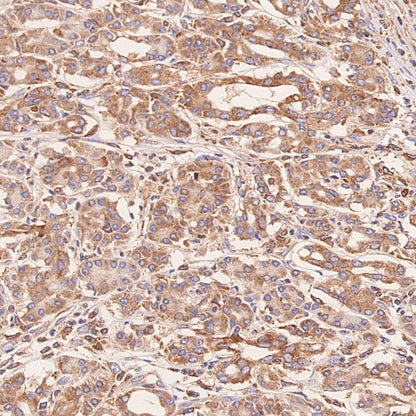 ERAP1 Recombinant Rabbit mAb (S-2509-38)