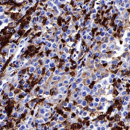 Mouse Anti-Human CD45RO Antibody (UCHL1)