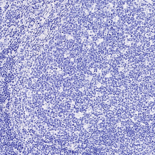 Human folate receptor alpha Recombinant Rabbit mAb (SDT-719-684)