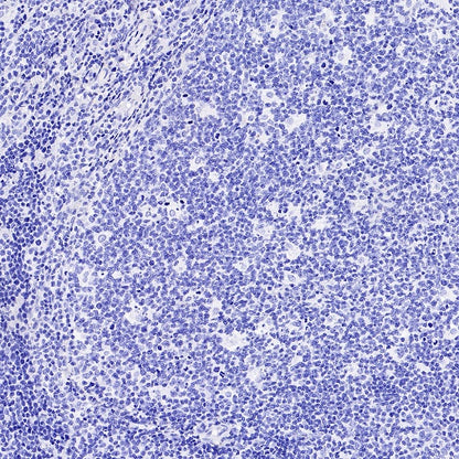 Human folate receptor alpha Recombinant Rabbit mAb (SDT-719-684)