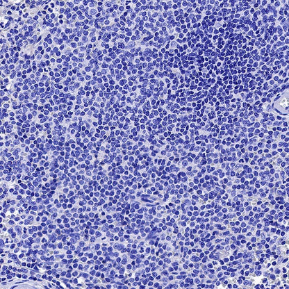 NaK-ATPase Recombinant Rabbit mAb (S-1373-39)