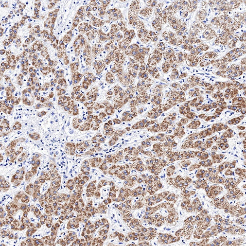 CPS1 Recombinant Rabbit mAb (S-674-9)