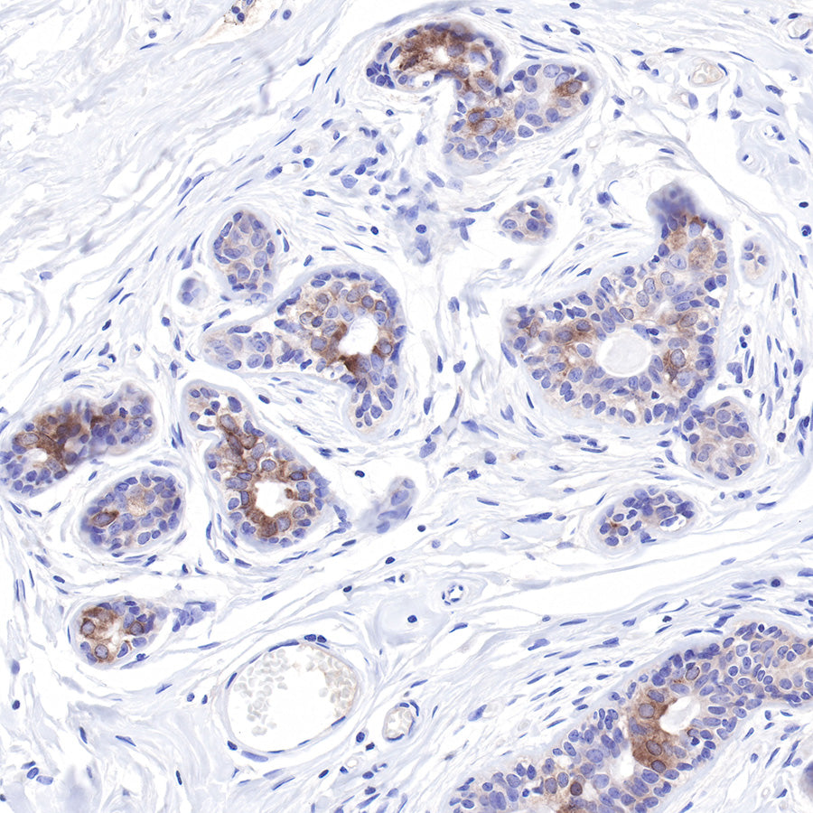 LIV-1/SLC39A6 Recombinant Rabbit mAb (SDT-206-84)